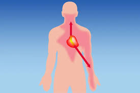 image showing where on a human angina can be felt